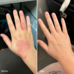 Dermatitis Control & Healthy Skin Cream - Relieves Itching, Redness & Flaking 50ml - Image 9