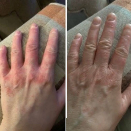 Click to view full screen Dermatitis Control & Healthy Skin Cream - Relieves Itching, Redness & Flaking 50ml photo review