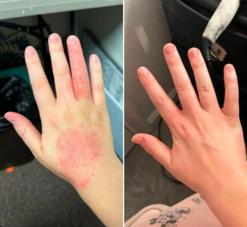 Click to view full screen Dermatitis Control & Healthy Skin Cream - Relieves Itching, Redness & Flaking 50ml photo review
